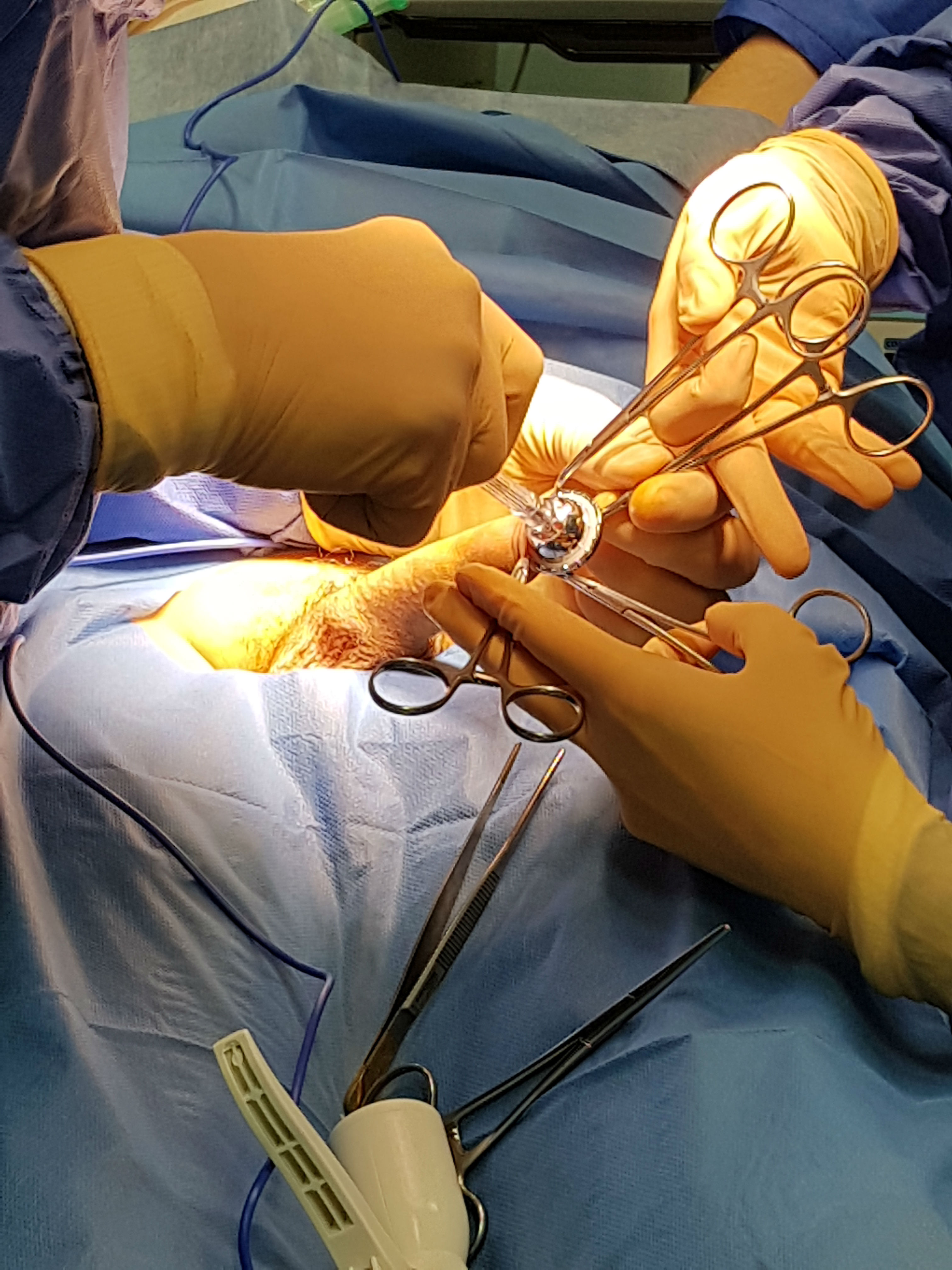 15-year-old french phimosis patient-2.jpg